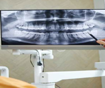 Monitor showing X-ray image of the spinal column