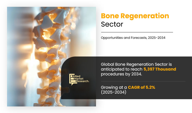 Bone Regeneration Sector Volume Insights