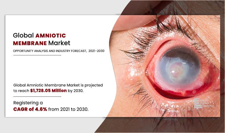 Amniotic-Membrane-Market