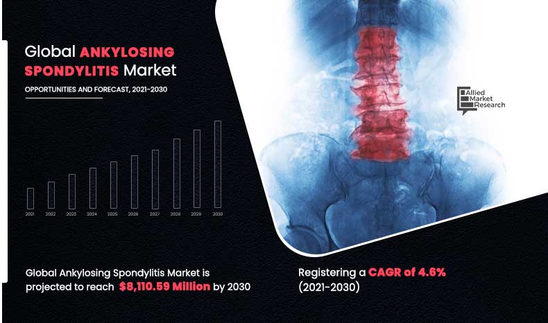 Ankylosing-Spondylitis-Market,-2021-2030	