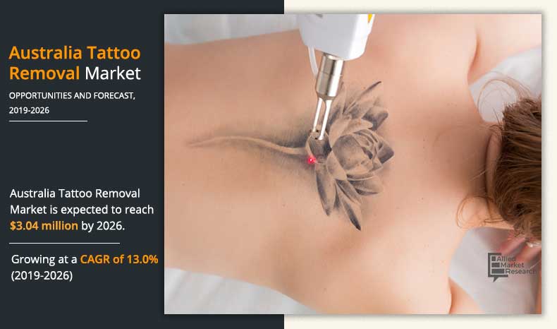 What Happens During Laser Tattoo Removal Process Fresh Skin Canvas
