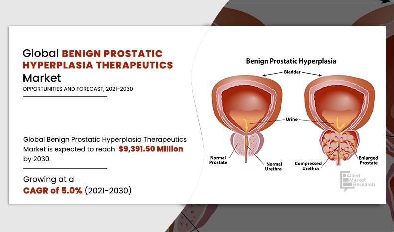 Benign-Prostatic-Hyperplasia-Therapeutics-Market