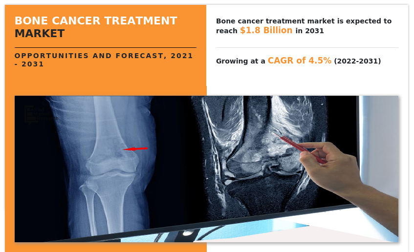 Bone Cancer Treatment Market, Bone Cancer Treatment Market Size, Bone Cancer Treatment Market Share, Bone Cancer Treatment Market Analysis, Bone Cancer Treatment Market Growth, Bone Cancer Treatment Market Opportunity, Bone Cancer Treatment Market Trends, Bone Cancer Treatment Market Forecast