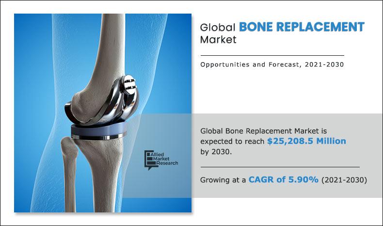 Bone-Replacement--Market--2021-2030