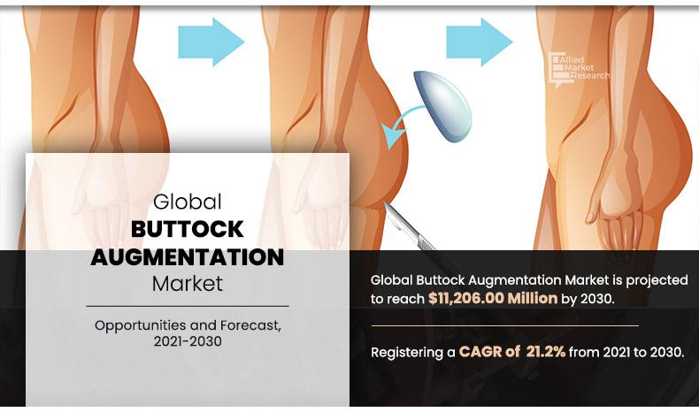 Buttock-Augmentation-Market