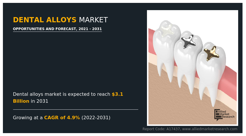 Dental Alloys Market