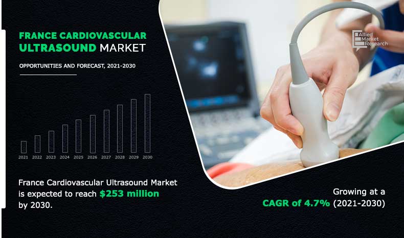 France-Cardiovascular-Ultrasound-Market