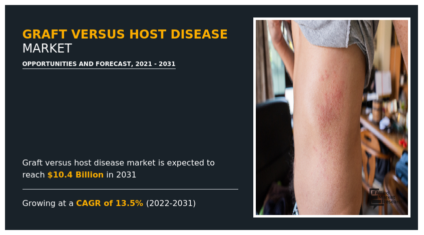 Graft Versus Host Disease Market, GVHD Market, Graft Versus Host Disease Market Size, Graft Versus Host Disease Market Share, Graft Versus Host Disease Market Analysis, Graft Versus Host Disease Market Growth, Graft Versus Host Disease Market Opportunity, Graft Versus Host Disease Market Trends, Graft Versus Host Disease Market Forecast, GVHD Market Size