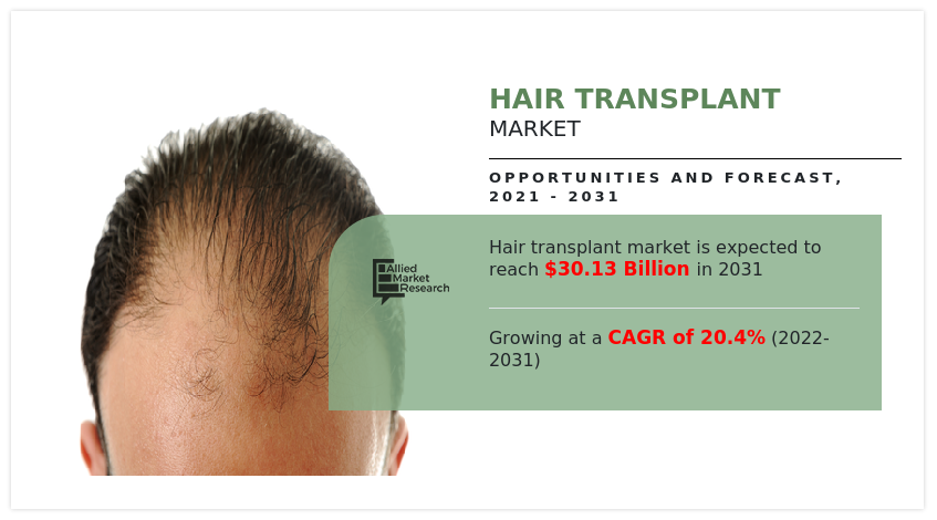 Hair Transplant Market, Hair Transplant Market size, Hair Transplant Market share, Hair Transplant Market trends, Hair Transplant Market growth, Hair Transplant Market analysis, Hair Transplant Market forecast, Hair Transplant Market opportunity