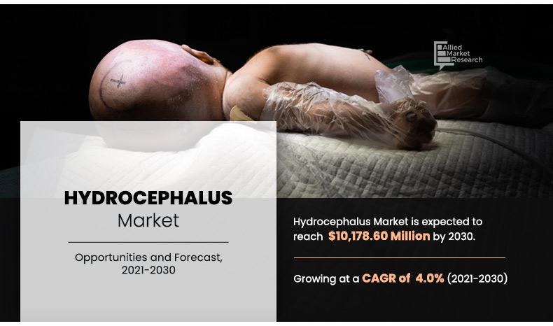 Hydrocephalus-Market