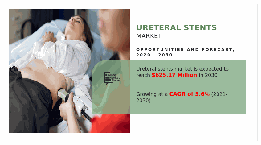 Ureteral Stents Market, Ureteral Stents Market size, Ureteral Stents Market share, Ureteral Stents Market trends, Ureteral Stents Market growth, Ureteral Stents Market forecast, Ureteral Stents Market analysis, Ureteral Stents Market opportunity