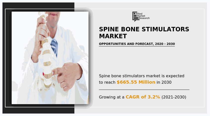 Spine Bone Stimulators Market, Spine Bone Stimulators Market Size, Spine Bone Stimulators Market Share, Spine Bone Stimulators Market Analysis, Spine Bone Stimulators Market Growth, Spine Bone Stimulators Market Opportunity, Spine Bone Stimulators Market Trends, Spine Bone Stimulators Market Forecast