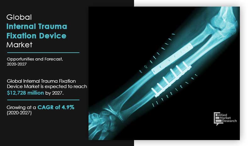 Internal-Trauma-Fixation-Device-Market,-2020-2027