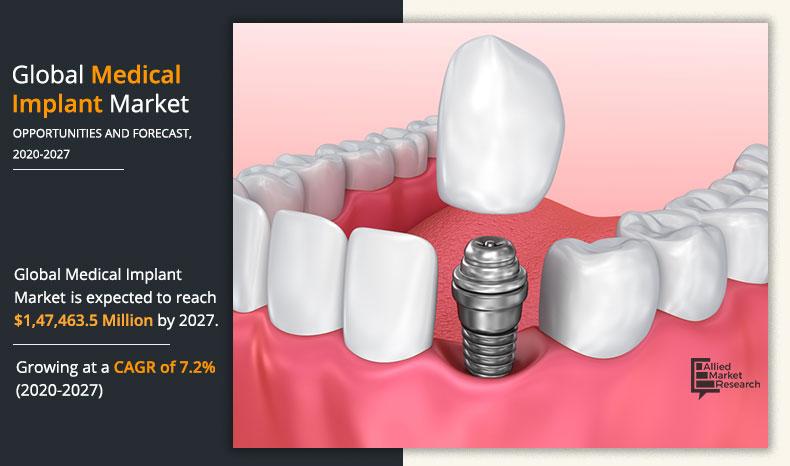 medical-implant-market-2020-2027-1606982291	