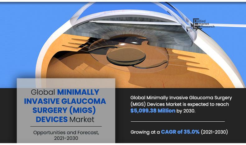 Minimally-Invasive-Glaucoma-Surgery-(MIGS)-Devices-Market-2021-2030