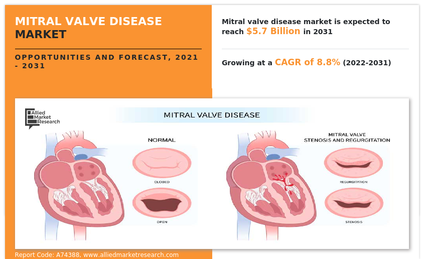 Mitral Valve Disease Market