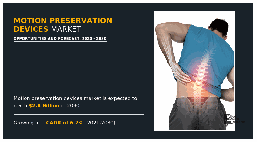 Motion Preservation Devices Market, Motion Preservation Devices Market size, Motion Preservation Devices Market share, Motion Preservation Devices Market trends, Motion Preservation Devices Market growth, Motion Preservation Devices Market analysis, Motion Preservation Devices Market forecast, Motion Preservation Devices Market opportunity