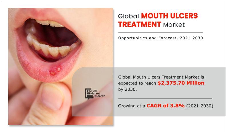 aphthous ulcers