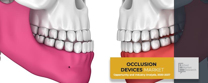 Occlusion-Devices	