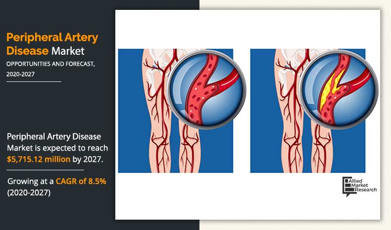 Peripheral-Artery-Disease-Market-2020-2027	
