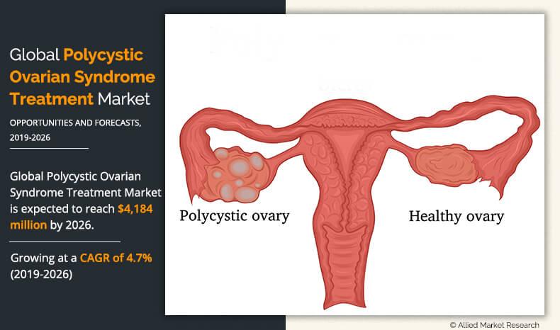 Polycystic Ovarian Syndrome Treatment Market