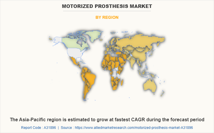 Motorized Prosthesis Market by Region