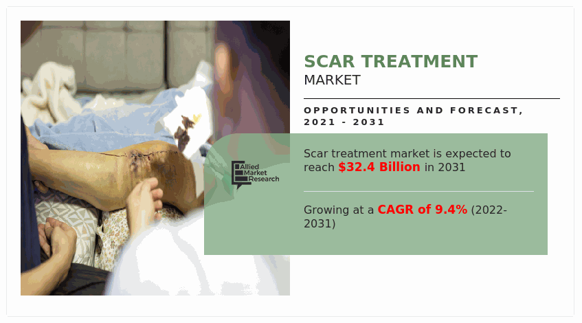 Scar Treatment Market, Scar Treatment Market Size, Scar Treatment Market Share, Scar Treatment Market Analysis, Scar Treatment Market Growth, Scar Treatment Market Opportunity, Scar Treatment Market Trends