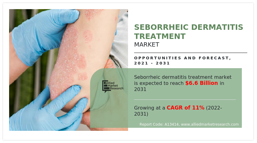 Seborrheic Dermatitis Treatment Market