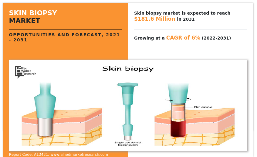 Skin Biopsy Market