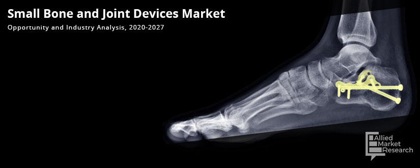 Small-Bone-and-Joint-Devices-Market