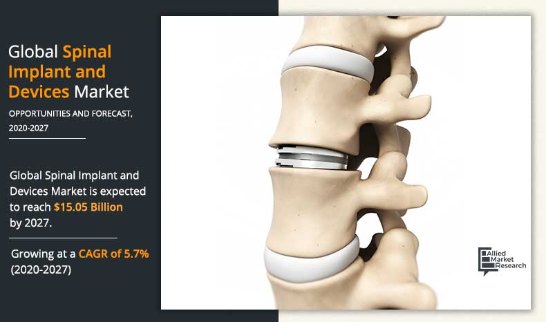 Spinal-Implant-and-Devices-Market-2020-2027	