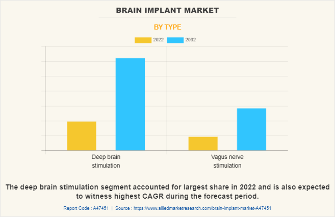 Brain Implant Market by Type