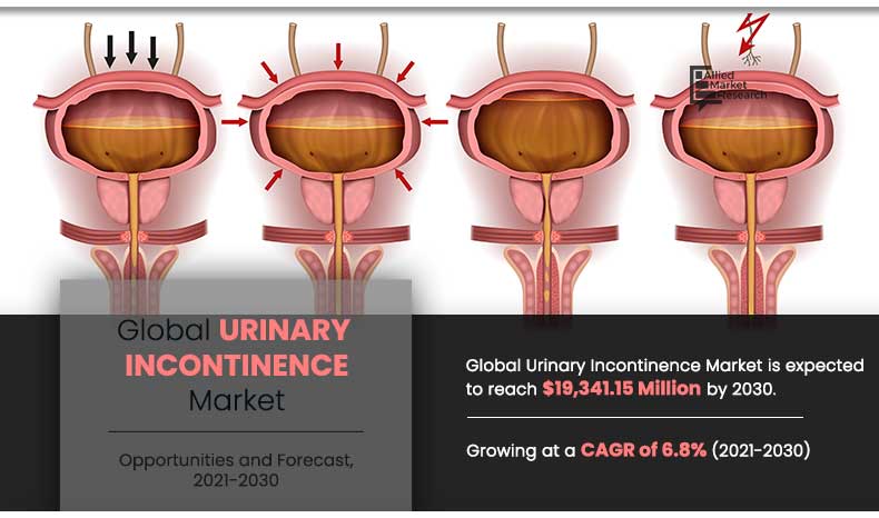urinary-incontinence-market-2021-2030