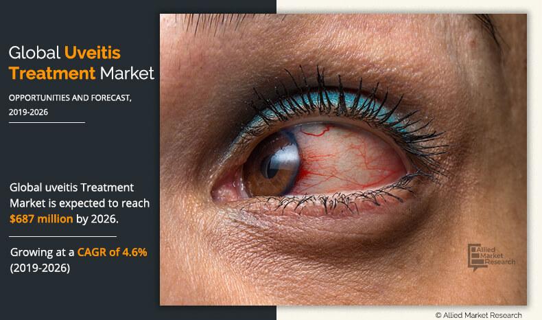 uveitis Treatment Market	