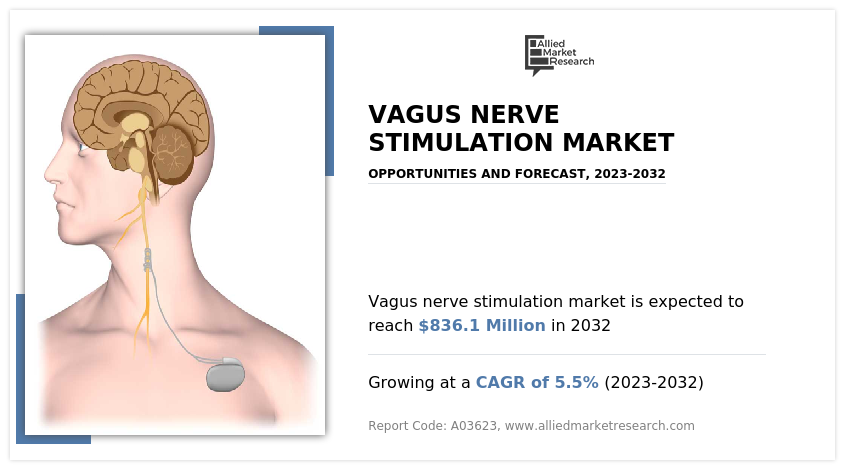 https://www.alliedmarketresearch.com/assets/sampleimages/vagus-nerve-stimulation-market-1682421783.png