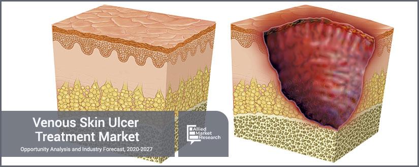 Venous-Skin-Ulcer-Treatment