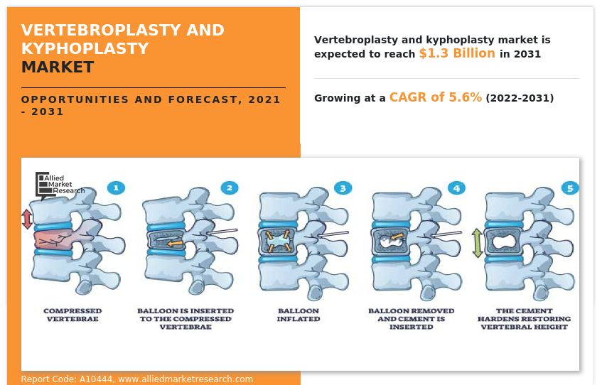 Vertebroplasty and Kyphoplasty Market