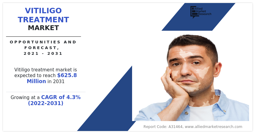 Vitiligo Treatment Market