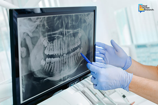 Explained: The Inherent Advantages of Dynamic Digital Radiography and ...