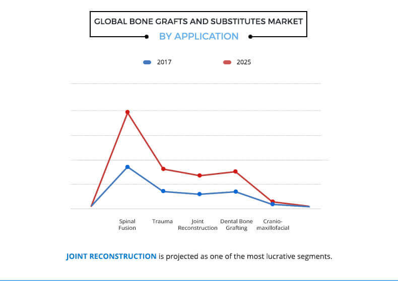 Bone Grafts And Substitutes Market Size Share And Forecast 2025